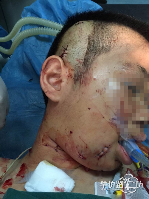 发指!医院工作人员小孩被患者尾随 公交车上被连捅数刀!